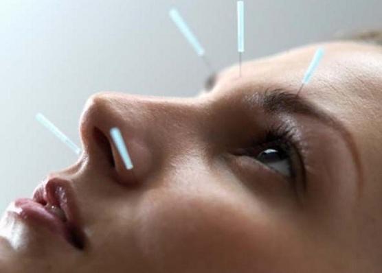 Тактика лечения неврита лицевого нерва