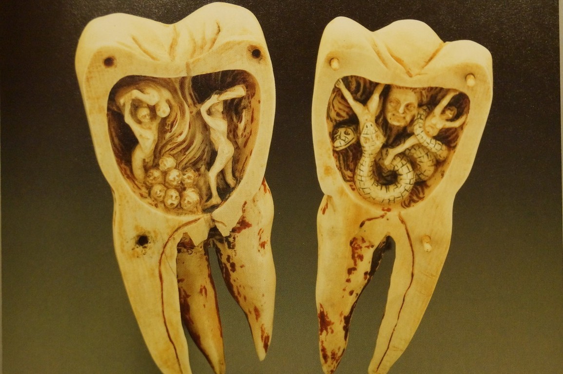 "Зубные черви", вызывающие зубную боль