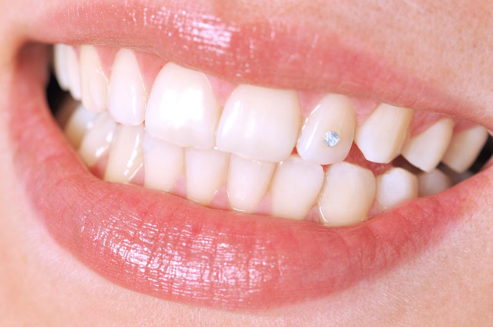 Лечение некроза твердых тканей зуба